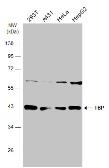 Anti-TBP antibody used in Western Blot (WB). GTX133204