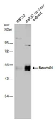 Anti-NeuroD1 antibody used in Western Blot (WB). GTX133207