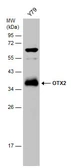 Anti-OTX2 antibody used in Western Blot (WB). GTX133210