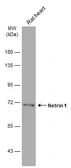 Anti-Netrin 1 antibody used in Western Blot (WB). GTX133213