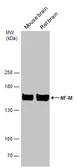 Anti-NF-M antibody used in Western Blot (WB). GTX133215