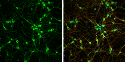 Anti-NF-M antibody used in Immunocytochemistry/ Immunofluorescence (ICC/IF). GTX133218