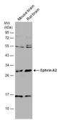 Anti-Ephrin A2 antibody used in Western Blot (WB). GTX133236