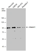 Anti-Ataxin 1 antibody used in Western Blot (WB). GTX133257