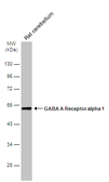 Anti-GABA A Receptor alpha 1 antibody used in Western Blot (WB). GTX133261