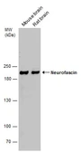 Anti-Neurofascin antibody used in Western Blot (WB). GTX133274