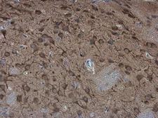 Anti-SAP102 antibody used in IHC (Paraffin sections) (IHC-P). GTX133279