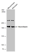 Anti-Neurofascin antibody used in Western Blot (WB). GTX133281