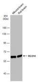 Anti-RGS14 antibody used in Western Blot (WB). GTX133291