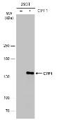 Anti-CPF1 antibody used in Western Blot (WB). GTX133297