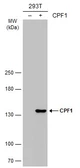 Anti-CPF1 antibody used in Western Blot (WB). GTX133301