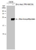 Anti-Zika virus prM protein antibody used in Western Blot (WB). GTX133305