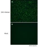 Anti-Zika virus NS2B protein antibody used in Immunocytochemistry/ Immunofluorescence (ICC/IF). GTX133308