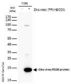Anti-Zika virus NS2B protein antibody used in Western Blot (WB). GTX133308