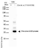 Anti-Zika virus NS4B protein antibody used in Western Blot (WB). GTX133311