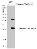 Anti-Zika virus NS4B protein antibody used in Western Blot (WB). GTX133311