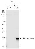 Anti-Zika virus Capsid protein antibody used in Western Blot (WB). GTX133317