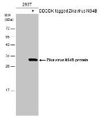 Anti-Zika virus NS4B protein antibody used in Western Blot (WB). GTX133321