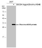 Anti-Zika virus NS4B protein antibody used in Western Blot (WB). GTX133321