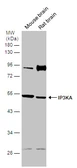 Anti-IP3KA antibody used in Western Blot (WB). GTX133334