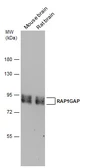 Anti-Rap1GAP antibody used in Western Blot (WB). GTX133335