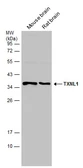 Anti-TXNL1 antibody used in Western Blot (WB). GTX133341