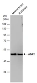 Anti-ABAT antibody used in Western Blot (WB). GTX133344