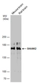 Anti-SHANK2 antibody used in Western Blot (WB). GTX133352