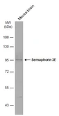 Anti-Semaphorin 3E antibody used in Western Blot (WB). GTX133361
