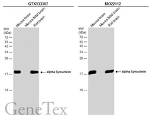 Anti-alpha Synuclein antibody used in Western Blot (WB). GTX133367