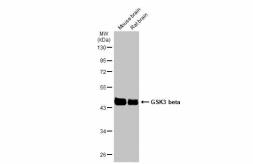 Anti-GSK3 beta antibody used in Western Blot (WB). GTX133372