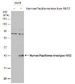 Anti-Human Papilloma virus type 18 E2 antibody used in Western Blot (WB). GTX133373