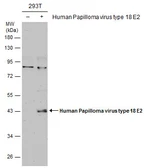 Anti-Human Papillomavirus type 18 E2 antibody used in Western Blot (WB). GTX133373