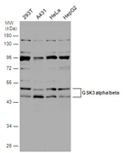 Anti-GSK3 alpha + GSK3 beta antibody used in Western Blot (WB). GTX133375