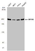 Anti-MYH10 antibody used in Western Blot (WB). GTX133378