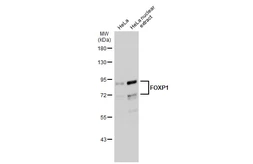 Anti-FOXP1 antibody used in Western Blot (WB). GTX133394