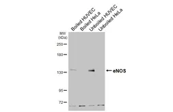 Anti-eNOS antibody used in Western Blot (WB). GTX133404