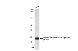 Human Papillomavirus type 16 E7 protein, His tag. GTX133411-pro
