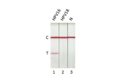 Human Papillomavirus type 16 E7 protein, His tag. GTX133411-pro