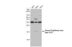 Anti-Human Papilloma virus type 16 E7 antibody used in Western Blot (WB). GTX133411