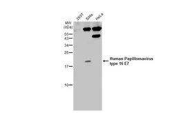 Anti-Human Papillomavirus type 16 E7 antibody used in Western Blot (WB). GTX133411