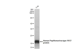 Human Papillomavirus type 18 E7 protein, His tag. GTX133412-pro