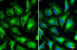Anti-Human Papilloma virus type 18 E7 antibody used in Immunocytochemistry/ Immunofluorescence (ICC/IF). GTX133412