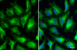 Anti-Human Papillomavirus type 18 E7 antibody used in Immunocytochemistry/ Immunofluorescence (ICC/IF). GTX133412