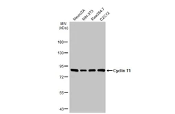 Anti-Cyclin T1 antibody used in Western Blot (WB). GTX133413