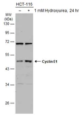 Anti-Cyclin E1 antibody used in Western Blot (WB). GTX133414