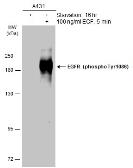 Anti-EGFR (phospho Tyr1086) antibody used in Western Blot (WB). GTX133421