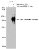 Anti-EGFR (phospho Tyr1086) antibody used in Western Blot (WB). GTX133421