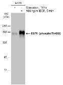 Anti-EGFR (phospho Thr669) antibody used in Western Blot (WB). GTX133425