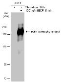 Anti-EGFR (phospho Tyr998) antibody used in Western Blot (WB). GTX133427